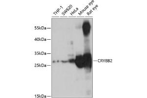 Western blot analysis of extracts of various cell lines, using CRYBB2 antibody (ABIN6130971, ABIN6139077, ABIN6139078 and ABIN6221220) at 1:1000 dilution. (CRYbB2 anticorps  (AA 1-205))