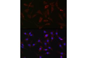 Immunofluorescence analysis of NIH/3T3 cells using [KO Validated] HK1 Rabbit pAb (ABIN3021308, ABIN3021309, ABIN3021310 and ABIN6214823) at dilution of 1:50 (40x lens). (Hexokinase 1 anticorps  (AA 20-300))