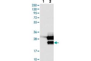 Western blot analysis of Lane 1: Negative control (vector only transfected HEK293T lysate). (TCF21 anticorps)