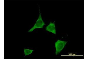 Immunofluorescence of monoclonal antibody to CAMK2D on NIH/3T3 cell. (CAMK2D anticorps  (AA 301-410))
