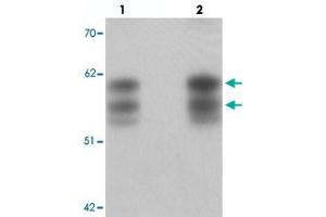 Western blot analysis of NSRP1 in human brain tissue with NSRP1 polyclonal antibody  at (lane 1) 0. (NSRP1 anticorps  (C-Term))