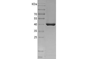 Western Blotting (WB) image for Plasminogen Activator Inhibitor 1 (SERPINE1) (AA 24-402) protein (His tag) (ABIN7124467) (PAI1 Protein (AA 24-402) (His tag))