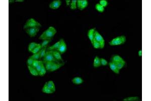Immunofluorescence staining of HepG2 cells with ABIN7157138 at 1:66, counter-stained with DAPI. (IST1 anticorps  (AA 172-284))