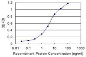 Detection limit for recombinant GST tagged SERBP1 is 0.