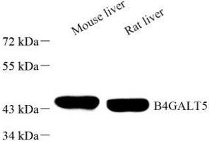 Western blot analysis of B4GALT5 (ABIN7076138) at dilution of 1: 1000 (B4GALT5 anticorps)