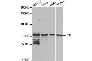 Western blot analysis of extracts of various cell lines, using CFB antibody. (Complement Factor B anticorps  (AA 80-420))