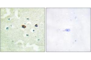 Immunohistochemistry analysis of paraffin-embedded human brain, using PTP1B (Phospho-Ser50) Antibody. (PTPN1 anticorps  (pSer50))
