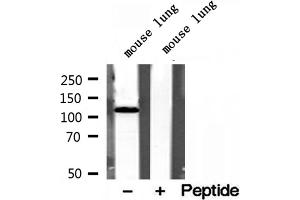 Western blot analysis of extracts of mouse lung tissue, using OGDH antibody. (alpha KGDHC anticorps  (N-Term))