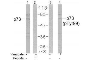 Image no. 1 for anti-Tumor Protein P73 (TP73) (Tyr99) antibody (ABIN197232) (Tumor Protein p73 anticorps  (Tyr99))