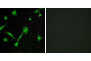 P-peptide - +Immunofluorescence analysis of LOVO cells, using IκB-α (Phospho-Ser32/Ser36) antibody. (NFKBIA anticorps  (pSer32, pSer36))