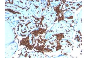 Formalin-fixed, paraffin-embedded human Placenta stained with Glycophorin A Recombinant Rabbit Monoclonal Antibody (GYPA/3219R). (Recombinant CD235a/GYPA anticorps)