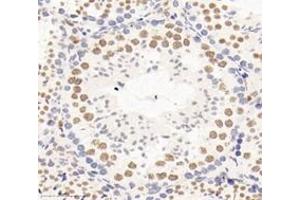 Immunohistochemistry analysis of paraffin-embedded mouse testis using,PSIP1 (ABIN7074997) at dilution of 1: 3000