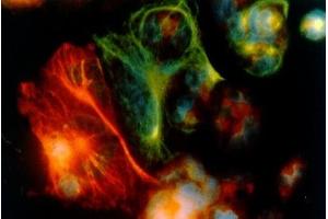 Image no. 1 for anti-Keratin 18 (KRT18) antibody (ABIN335330)