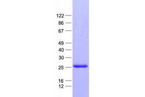 Validation with Western Blot