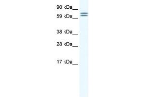 WB Suggested Anti-CES6 Antibody Titration:  1. (CES4A anticorps  (Middle Region))