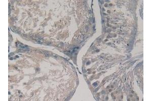 Detection of GREM1 in Human Testis Tissue using Polyclonal Antibody to Gremlin 1 (GREM1)