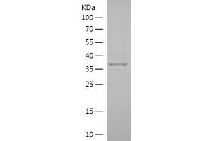Western Blotting (WB) image for Phosphatidylinositol Glycan Anchor Biosynthesis, Class Z (PIGZ) (AA 431-579) protein (His-IF2DI Tag) (ABIN7124402)