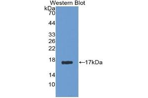 Detection of Recombinant AGMAT, Human using Polyclonal Antibody to Agmatine Ureohydrolase (AGMAT)