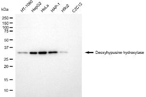 Western blotting analysis using deoxyhypusine hydroxylase antibody (ABIN7798308).