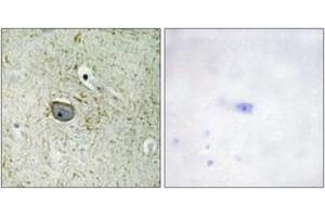 Immunohistochemistry analysis of paraffin-embedded human brain tissue, using PDGFR alpha (Ab-762) Antibody. (PDGFRA anticorps  (AA 731-780))