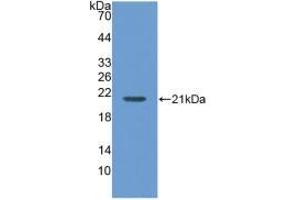Western blot analysis of recombinant Human MGA. (AGLU anticorps  (AA 213-392))