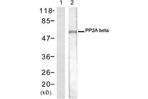 Western blot analysis of extracts from 293 cells using PP2A-beta antibody (E021404, Lane 1 and 2). (PPP2CB anticorps)