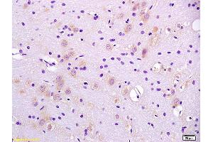 Formalin-fixed and paraffin embedded rat brain labeled with Anti-CaIPLA2/PLA2G6 Polyclonal Antibody, Unconjugated (ABIN720281) at 1:200 followed by conjugation to the secondary antibody and DAB staining. (PLA2G6 anticorps  (AA 651-750))