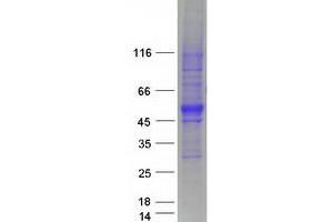Validation with Western Blot