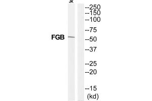 Western Blotting (WB) image for anti-Fibrinogen beta Chain (FGB) (C-Term) antibody (ABIN1852789) (Fibrinogen beta Chain anticorps  (C-Term))