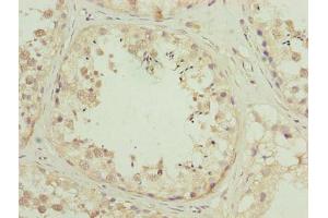 Immunohistochemistry of paraffin-embedded human testis tissue using ABIN7176441 at dilution of 1:100