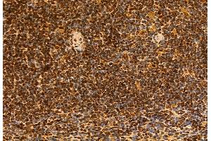 ABIN6265263 and ABIN6272950 at 1/100 staining Mouse spleen tissue by IHC-P.