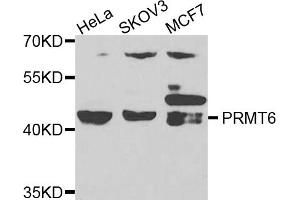 Western blot analysis of extracts of various cell lines, using PRMT6 antibody. (PRMT6 anticorps)