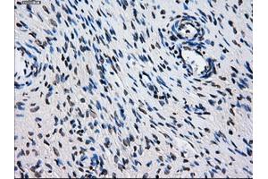 Immunohistochemical staining of paraffin-embedded colon tissue using anti-L1CAMmouse monoclonal antibody. (L1CAM anticorps)