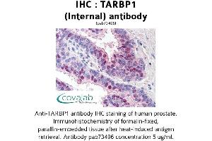 Image no. 1 for anti-TAR (HIV-1) RNA Binding Protein 1 (TARBP1) (Internal Region) antibody (ABIN1739905) (TARBP1 anticorps  (Internal Region))