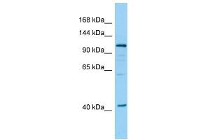 Host: Rabbit Target Name: DHTKD1 Sample Type: 293T Whole Cell lysates Antibody Dilution: 1. (DHTKD1 anticorps  (N-Term))