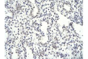 Rabbit Anti-NFYC antibody        Paraffin Embedded Tissue:  Human Lung cell   Cellular Data:  Epithelial cells of renal tubule  Antibody Concentration:   4.