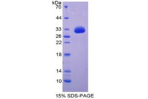 SDS-PAGE analysis of Human GDF11 Protein. (GDF11 Protéine)