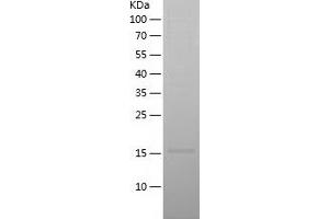 Western Blotting (WB) image for Interleukin 17A (IL17A) (AA 24-155) protein (His tag) (ABIN7123555)