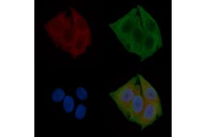 ABIN6260435 and ABIN6272263 staining Hela cells(24h of starvation treatment) by IF/ICC. (CaMK2 beta/gamma anticorps  (C-Term))