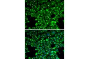 Immunofluorescence analysis of U20S cell using LYZL6 antibody. (LYZL6 anticorps  (AA 20-148))