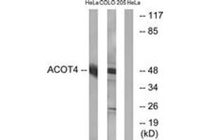 Western blot analysis of extracts from HeLa/COLO cells, using ACOT4 Antibody. (ACOT4 anticorps  (AA 361-410))