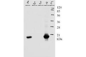 Western Blotting (WB) image for anti-Human Papilloma Virus 11 E7 (HPV-11 E7) (AA 1-35), (N-Term) antibody (ABIN781776) (Humain Papilloma Virus 11 E7 (HPV-11 E7) (AA 1-35), (N-Term) anticorps)