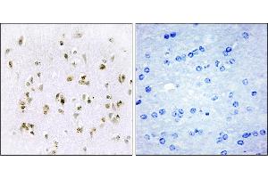 Immunohistochemistry analysis of paraffin-embedded human brain tissue, using HMG17 antibody. (HMGN2 anticorps)