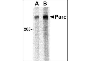 Western blot analysis of PARC in Daudi lysate with this product at (A) 1 and (B) 2 μg/ml.