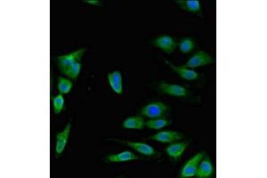 anti-Disrupted in Schizophrenia 1 (DISC1) (AA 99-325) antibody
