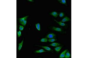 Immunofluorescent analysis of Hela cells using ABIN7150092 at dilution of 1:100 and Alexa Fluor 488-congugated AffiniPure Goat Anti-Rabbit IgG(H+L) (DISC1 anticorps  (AA 99-325))