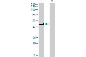 Western Blot analysis of MVD expression in transfected 293T cell line by MVD monoclonal antibody (M01), clone 2A7.