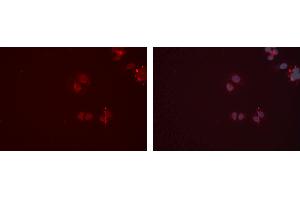 ABIN6277347 staining Hela cells by IF/ICC. (CPT2 anticorps  (Internal Region))