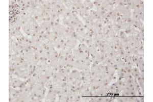 anti-Bromodomain Adjacent To Zinc Finger Domain, 1B (BAZ1B) (AA 1384-1483) antibody