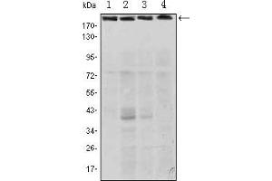 Western blot analysis using RICTOR mouse mAb against Hela (1), PANC-1 (2), MOLT4 (3), and HepG2 (4) cell lysate.